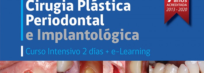 cirugia-plastica-periodontal