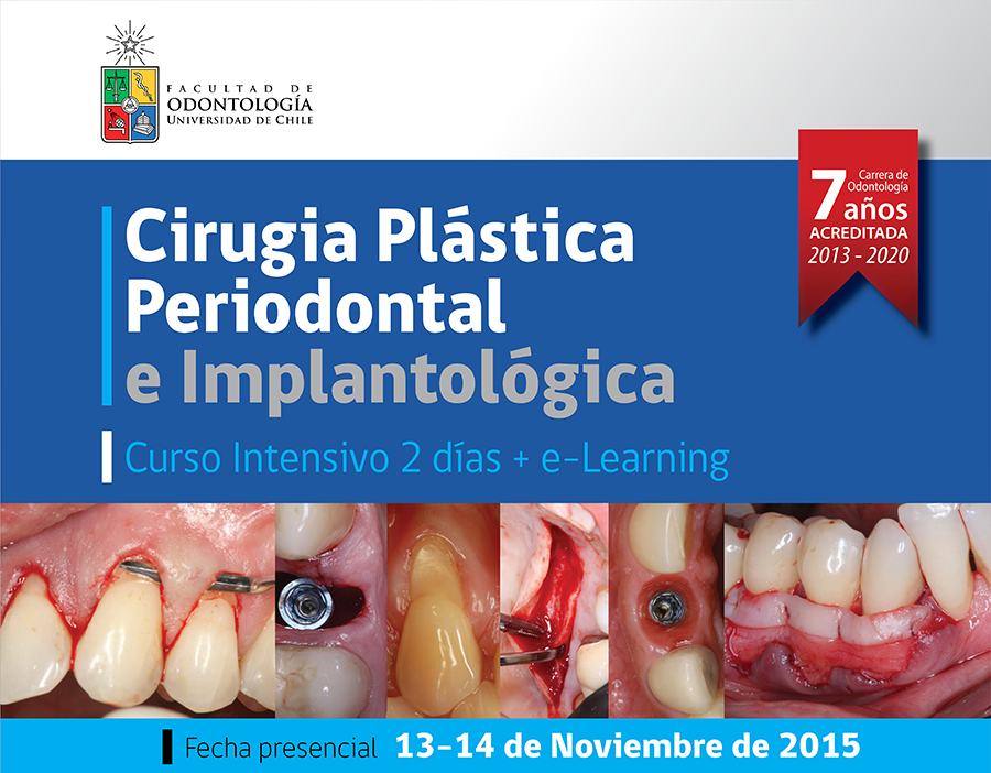 cirugia-plastica-periodontal